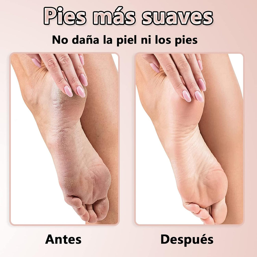 LIMA PEDICURE PRO® - CONSIGUE 3 LIJAS GRATIS